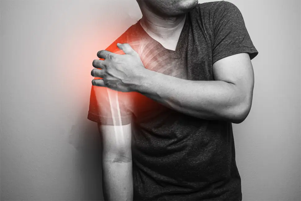 Fractura de clavicula – tratament si vindecare