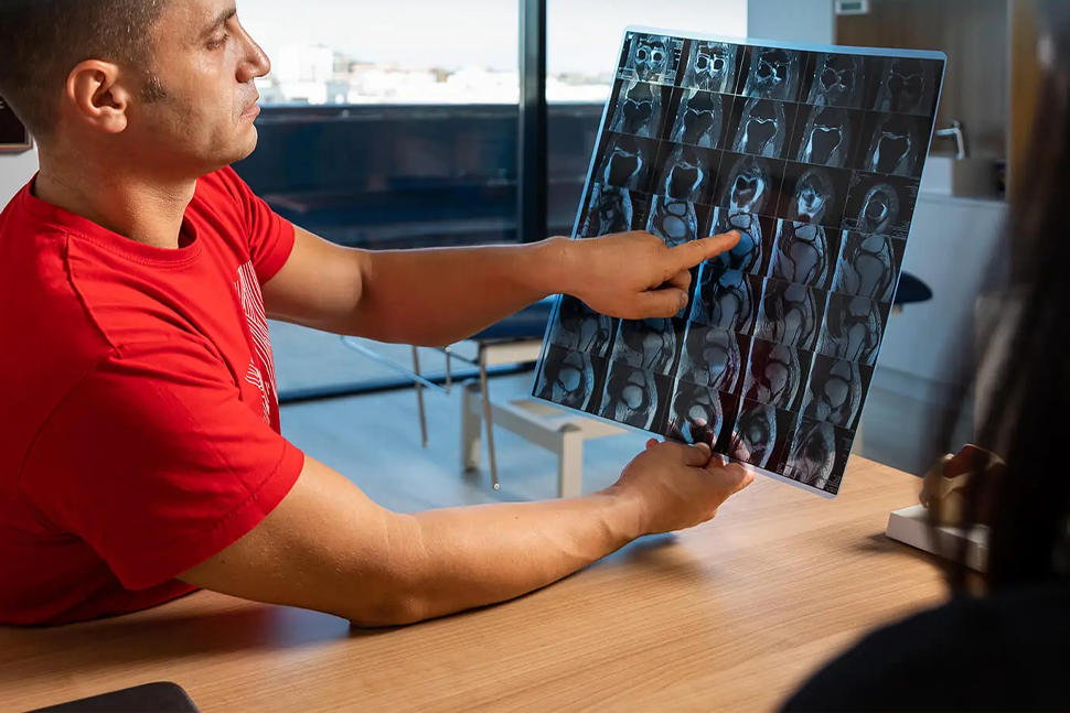 Artroza – cauze, simptome si tratamente eficiente pentru sanatatea articulatiilor