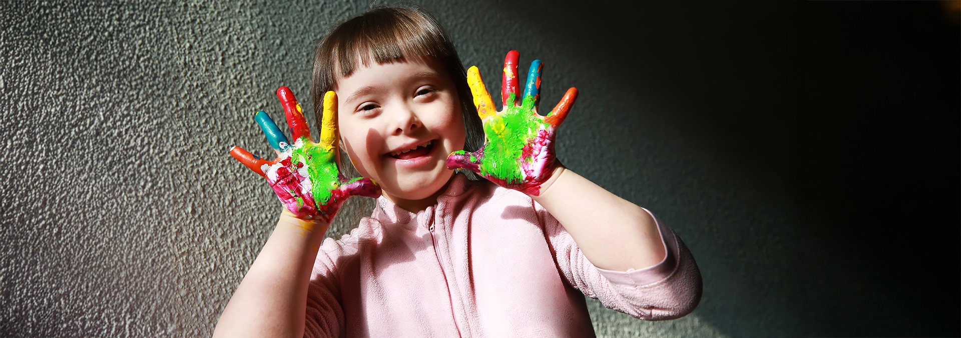 Tot ce trebuie sa stii despre Sindromul Down (Trisomia 21): semne in sarcina si dezvoltare